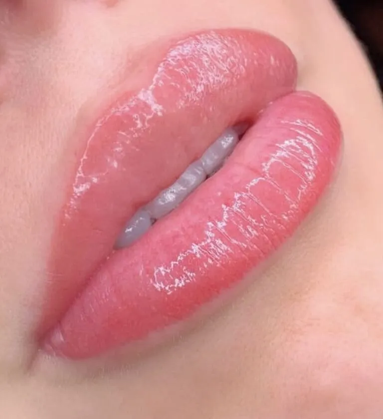 Lip blush result