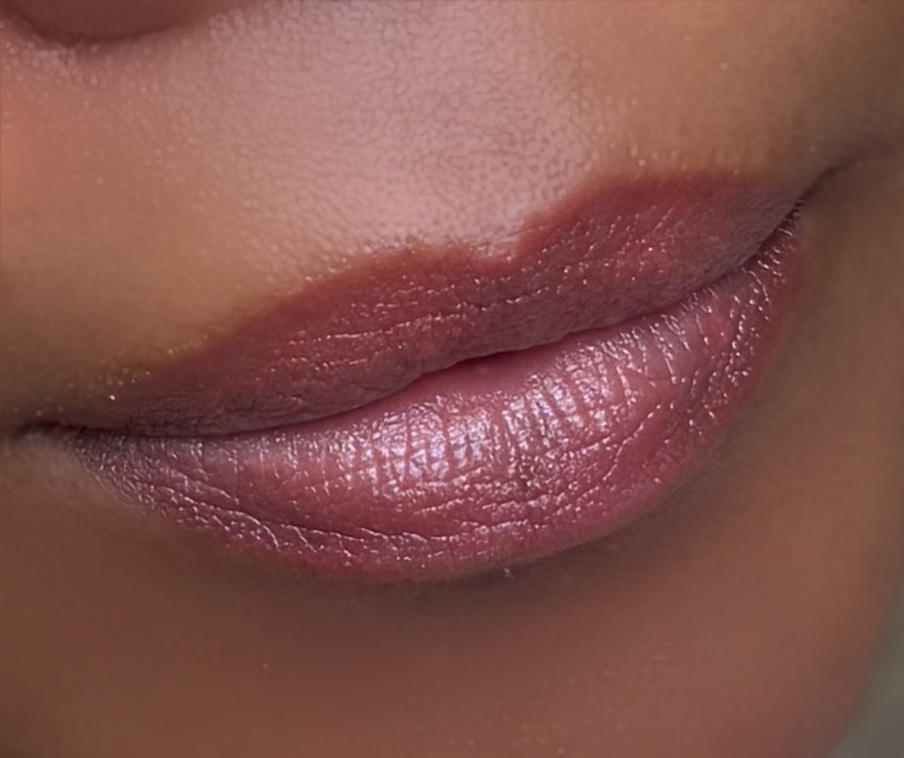Lip Neutralization